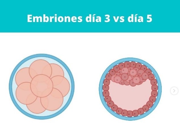Embriones día 3 vs día 5