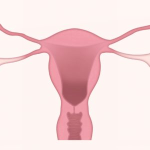 Malformaciones uterinas