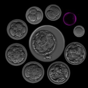 Clasificación embrionaria II