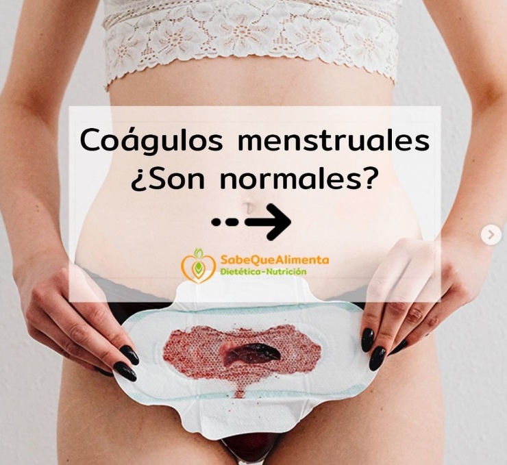 Coágulos menstruales, ¿son normales?