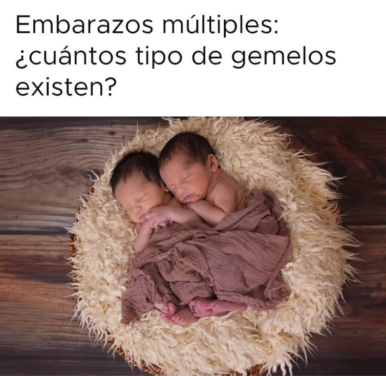 Embarazos múltiples: ¿Cuántos tipo de gemelos existen?